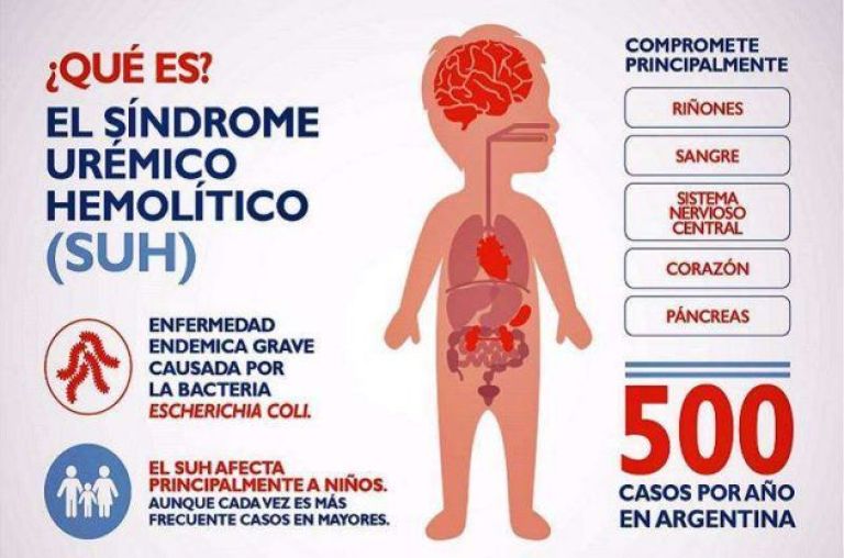 Síndrome Urémico Hemolítico recomendaciones a seguir El Orden de